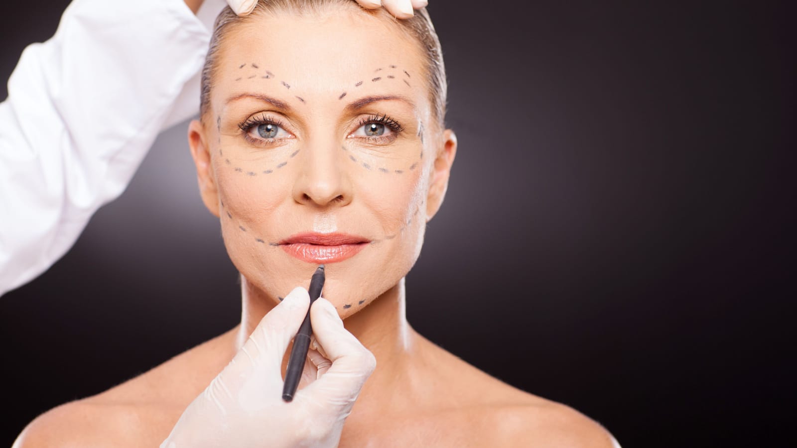 mid age woman with correction mark for plastic surgery